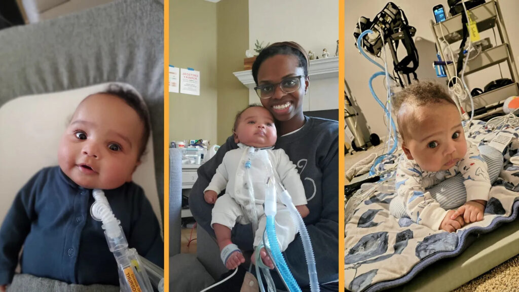 Baby Cassian Story