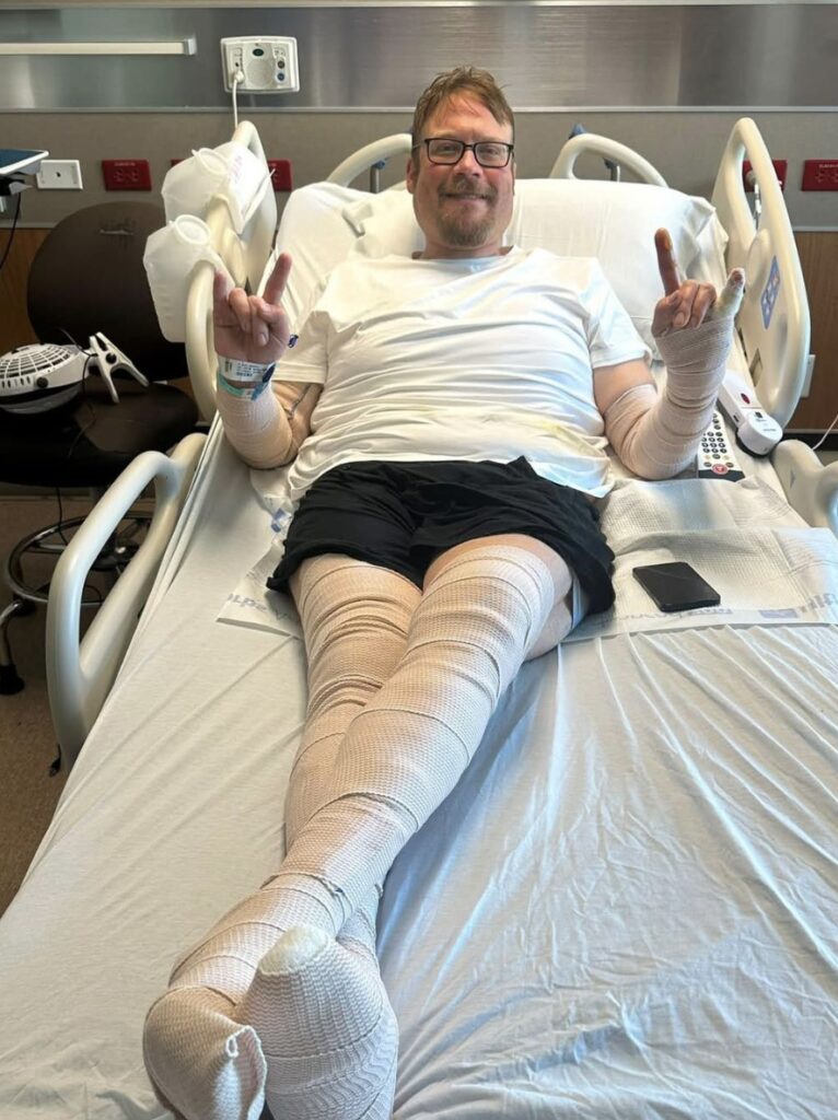 Texas café owner J.B. Royer suffered severe burns from scalding hot grease in an accident on July 4.